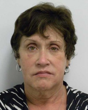 Facelift Case 6167 Before Photo Facelift