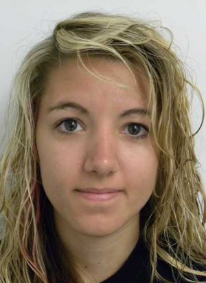Rhinoplasty/Nose Reshaping Case 6508 After Photo Rhinoplasty/Nose Reshaping