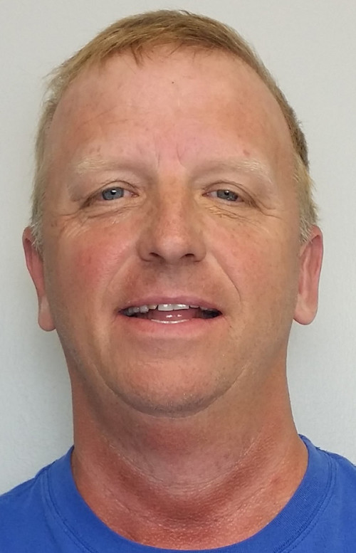 Otoplasty/Cosmetic Ear Surgery Case 10186 After Photo Otoplasty/Cosmetic Ear Surgery