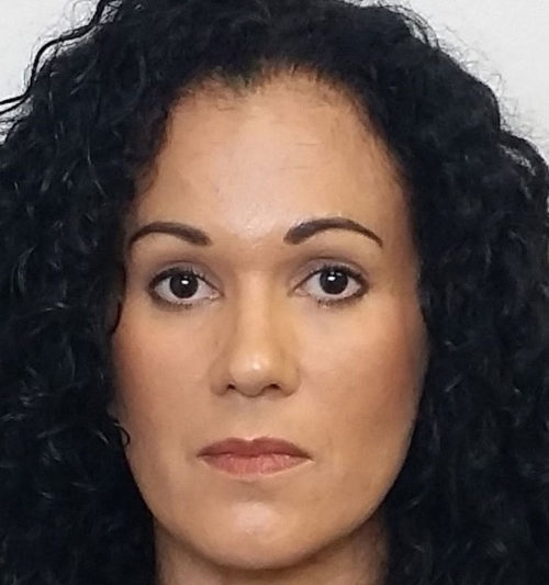 Brow Lift/Forehead Rejuvenation Case 10454 After Photo Brow Lift/Forehead Rejuvenation